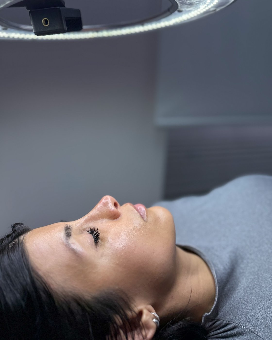 Tratamiento facial Dermapen en camilla