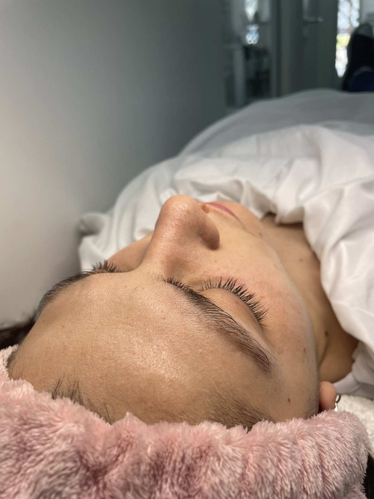 Tratamiento facial con radiofrecuencia