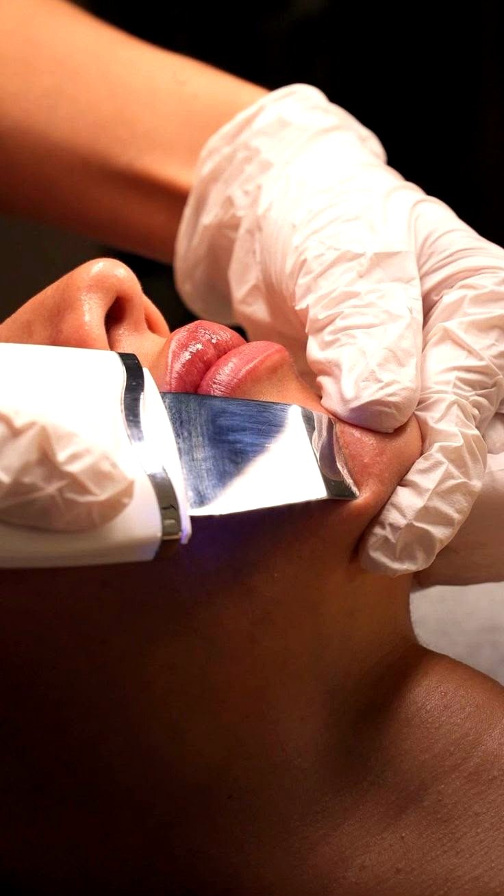 Dermaplaning facial profesional en Estética SA