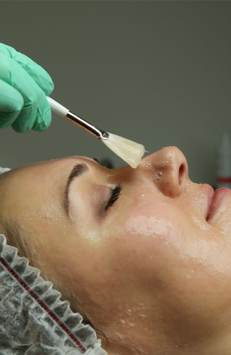 Aplicación de peeling facial con pincel